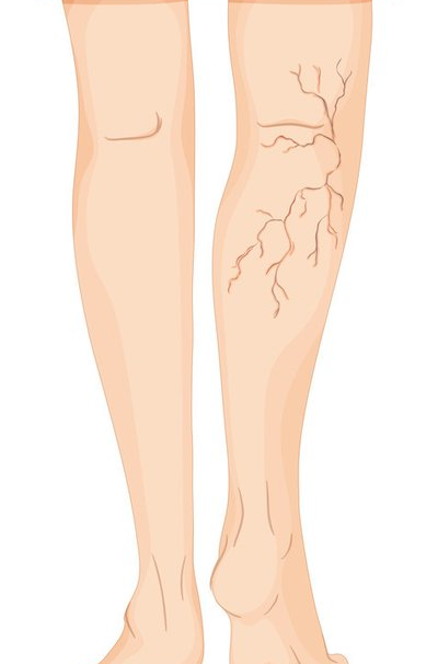 健康科普|| 小动作学起来——踝泵运动 促进下肢血液循环