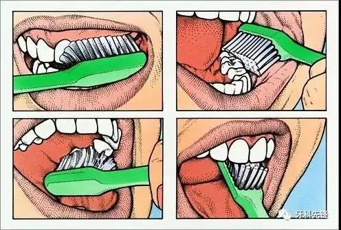 【口腔科】科普文章：电动牙刷真的值得买吗？