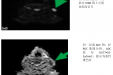 【放射科】放射科开展全身弥散加权成像新技术