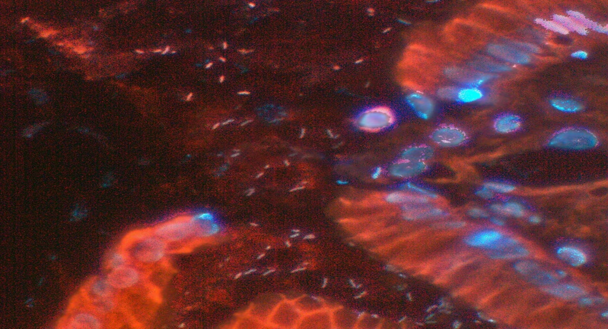 幽门螺旋杆菌免疫荧光染色