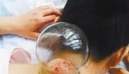 治未病中心助您从容面对“二阳”