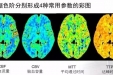 带您了解CT脑灌注成像