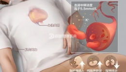认识高钾血症