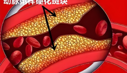 关于血脂，你了解多少呢？